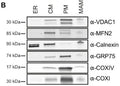 Western blot showing immunoblotting of cytochrome c oxidase I (COXI), cytochrome c oxidase IV (COXIV), GRP75/mortalin, VDAC1, MFN2 , and calnexin in various mouse whole brain fraction. ER (endoplasmic reticulum); CM (crude mitochondria); PM (pure mitochondria); MAM (mitochondria-associated membranes). Image from publication CC-BY-4.0. PMID: 35943566