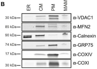 Western blot showing immunoblotting of cytochrome c oxidase I (COXI), cytochrome c oxidase IV (COXIV), GRP75/mortalin, VDAC1, MFN2 , and calnexin in various mouse whole brain fraction. ER (endoplasmic reticulum); CM (crude mitochondria); PM (pure mitochondria); MAM (mitochondria-associated membranes). Image from publication CC-BY-4.0. PMID: 35943566