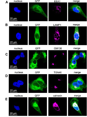 MDA-MB-231-β1-GFP cells were stained for (A) EEA1, (B) LAMP1, (C) GM130, (D) TGN46, (E) calnexin (all magenta), and DNA (DAPI, blue). GFP is shown in green. Image from publication CC-BY-4.0. PMID: 35752364