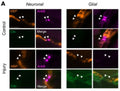 Immunostaining of ankyrin B (AnkB, magenta), MBP (orange), and C3c (green) in Neuronal and Glial injured mice in control and anti-GM1 treated groups. Image from publication CC-BY-4.0. PMID: 35671105