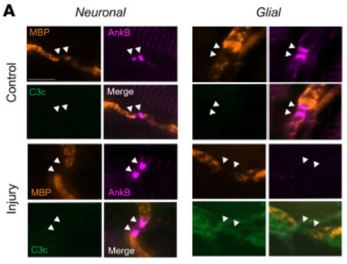 Immunostaining of ankyrin B (AnkB, magenta), MBP (orange), and C3c (green) in Neuronal and Glial injured mice in control and anti-GM1 treated groups. Image from publication CC-BY-4.0. PMID: 35671105