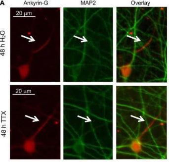 Cultured rat hippocampal neurons (DIV 11–12) were treated for 48 h with 1 μM TTX or its vehicle control (0.1% H2O) and subjected to immunocytochemistry with antibodies for the AIS marker ankyrin-G or somatodendritic marker MAP2. Image from publication CC-BY-4.0. PMID: 35966206