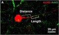Representative image of Alexa 555 (AL555, red) dye-filled RGC labeled for the axon initial segment (AIS) scaffolding protein ankyrin-G (AnkG, cat. 75-146, 1:200; green). Annotations demonstrate the dimensions of AIS distance from soma and length which were quantified. Image from publication CC-BY-4.0.