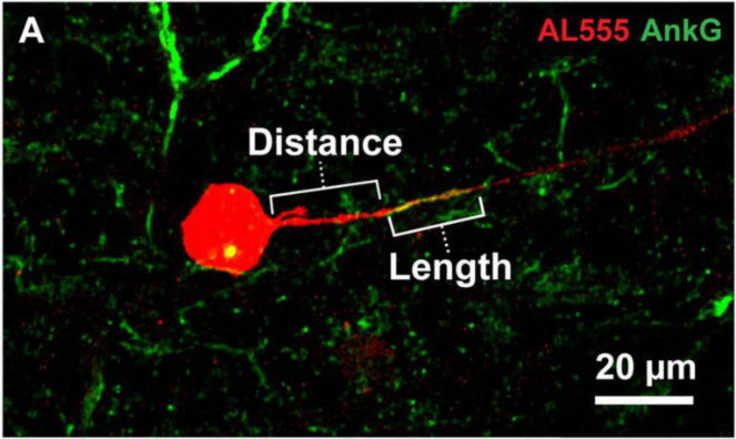 Representative image of Alexa 555 (AL555, red) dye-filled RGC labeled for the axon initial segment (AIS) scaffolding protein ankyrin-G (AnkG, cat. 75-146, 1:200; green). Annotations demonstrate the dimensions of AIS distance from soma and length which were quantified. Image from publication CC-BY-4.0. PMID:37051140