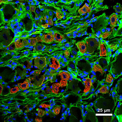 Immunostaining of a 7 µm thick DRG neuron section from a 3 month old rat labeling NaV1.8 (green, 1:2000, Cat. 75-166), IB4 (red), and nuclei is stained with DAPI (blue). The image is kindly provided by Cristian Acosta, Universidad Nacional de Cuyo, Mendoza, Argentina.