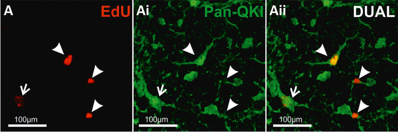 Representative confocal images of colocalisation of EdU+ and Pan-QKI in the dorsal WM of mouse spinal cord. Closed arrows denote colocalised cells, open arrows denote non-colocalised cells. Image from publication CC-BY-4.0. PMID:36336067