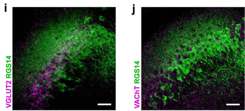 i. Confocal image of mouse CA2 immunolabeled with RGS14 (ca. 75-170, 1:500; green) and SUM afferent marker VGLUT2 (magenta). j Confocal image from the CA2 immunolabeled with RGS14 (ca. 75-170, 1:500; green) and cholinergic afferent marker VAChT (magenta). Image from publication CC-BY-4.0. PMID:36991001