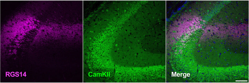 Coronal section from a C57BL/6J mouse showing the hippocampus co-stainedwith RGS14 (cat. 75-170, 1:500; pink) and CaMKII alpha (green). The merged image is shown on the right. Image from publication CC-BY-4.0. PMID:36971428