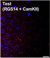 High magnification view of the central amygdala (CeA) ipsilateral to the insula with an AAV injection in mouse. Left: GFP, green(axon arbors restricted to the lateral and capsular divisions of the CeA (CeL/CeC)), middle: anti-RGS14 (Cat. 75-170, 1:500; magenta) immunostaining identifying the CeL/CeC but not medial division of the CeA (CeM), right: merged. Image from publication CC-BY-4.0.