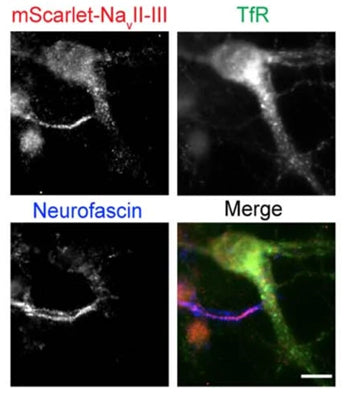 Neurons transfected with TfR-SEP and mScarlet-NavII-III, fixed at DIV10, and stained with anti-neurofascin (NF) antibody (clone A12/18) and anti-mScarlet antibody. Intense staining of both mScarlet-NavII-III and NF defines the AIS. 18/20 transfected neurons (from 3 cultures) showed colocalization with endogenous NF. Image from publication CC-BY-4.0. PMID: 35978188