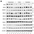 Western blot for mitochondrial Ca 2+ uptake proteins in hippocampus,cortex and cerebellum lysates from 6 month old contol mice (Control) and mice with haploinsufficiency of the mitochondrial Ca2+ uniporter (MCU+/−). Image from publication CC-BY-4.0. PMID:36274588