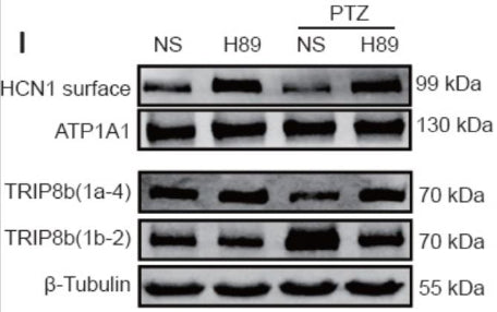 Western blotting results showing TRIP8b (1a-4), and TRIP8b(1b-2) labeling in hippocampal CA1 region of control group rats either treated with saline or a PKA inhibitor(H89) and pentylenetetrazole (PTZ) treated rats under the same experimental conditions. Image from publication CC-BY-4.0. PMID: 36018183