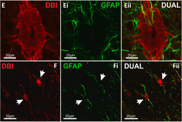 Confocal images showing labelling for DBI in ECL and GFAP+ glial fibers within lamina X of mouse spinal cord. Image from publication CC-BY-4.0. PMID:36336067