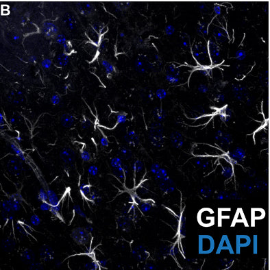 Representative image of GFP positive (white, cat. 75-240, 1:500) astrocytes near radioluminescent particles (RLP) injection site in mouse brain. Nuclei is stained with DAPI (blue). Image from publication CC-BY-4.0. PMID:36634053