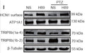Western blotting results showing TRIP8b (1a-4), and TRIP8b(1b-2) labeling in hippocampal CA1 region of control group rats either treated with saline or a PKA inhibitor(H89) and pentylenetetrazole (PTZ) treated rats under the same experimental conditions. Image from publication CC-BY-4.0. PMID: 36018183