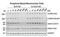 Representative Western blotting of total LRRK2, LRRK2-pSer935, pRab10, Rab10 total, and GAPDH levels following treating human peripheral blood mononuclear cells (PBMCs) with XL01126, a LRRK2 degrader, and cis-XL01126, a non-degrader control, at the indicated concentrations for 4 h. Image from publication CC-BY-4.0. PMID: 36007011