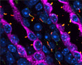 Spinning disc confocal image identifying localization of the atypical GTPase protein ARL13B (Cat. 75-287, red) in primary cilium, marked by acetylated tubulin (green), in Aquaporin 2 (magenta) positive renal collecting ducts in a 24-day