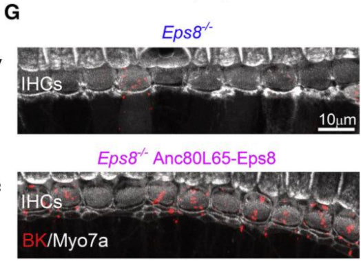 Maximum intensity projections of confocal z stacks taken from the apical cochlear region of Eps8−/− (top) and Eps8−/− rescued (bottom) mice using antibodies against BK channels carrying IK,f (red) and the hair-cell marker Myo7a (white). Image from publication CC-BY-4.0. PMID: 36034774