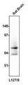 Western blotting of rat brain homogenate (10 ug/lane) with anti-GAD65/67 (L127/8) at 1:100 dilution and detected with anti-mouse HRP.