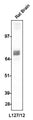 Western blotting of rat brain homogenate (10 ug/lane) with anti-GAD65/67 (L127/12) at 1:100 dilution and detected with anti-mouse HRP.