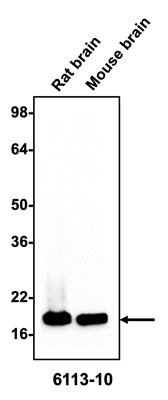 Western blotting of rat or mouse brain homogenate (10 µg/lane) with Antibodies Incorporated anti-alpha-synuclein antibodies at 1:200 dilution and detected with anti-mouse HRP.