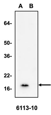 Western blotting of A) WT HEK-293T cell lysate or B) alpha-synuclein knockout HEK-293T cell lysate (10 µg/lane) with Antibodies Incorporated mouse anti-alpha-synuclein antibody (clone 6113-10).
