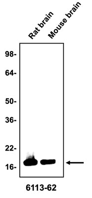 Western blotting of rat or mouse brain homogenate (10 µg/lane) with Antibodies Incorporated anti-alpha-synuclein antibodies at 1:200 dilution and detected with anti-mouse HRP.