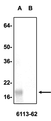 Western blotting of A) WT HEK-293T cell lysate or B) alpha-synuclein knockout HEK-293T cell lysate (10 µg/lane) with Antibodies Incorporated mouse anti-alpha-synuclein-antibody (clone 6113-62).