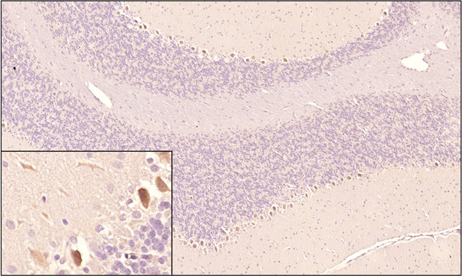Sagittal section of formalin-fixed, paraffin-embedded rat brain showing strong staining for SARM1 in the Purkinje layer of the cerebellum as expected. Inset image shows higher magnification. Sections were stained with Antibodies Incorporated mouse anti-SARM1 (clone 6174-11) antibody at 1:500 dilution and detected with anti-mouse HRP. 