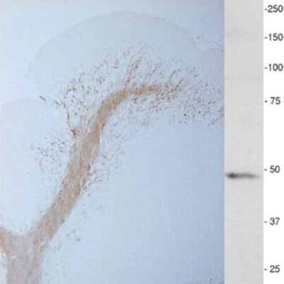 CNPase-positive oligodendrocytes (brown) in cerebellar white matter (adult mouse). Right: Western.