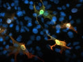 Immunofluorescence of AIF1/IBA1-FLAG transfected COS-7 cells using chicken α-AIF1/IBA1 (green) and mouse α-flag tag (red). Yellow/orange staining shows 100% correspondence between the two antibodies for recognition of transfected cells. Blue staining is DAPI and stains nuclei of both transfected and untransfected cells.