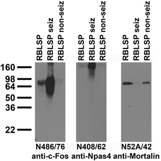 Anti-c-FOS Antibody