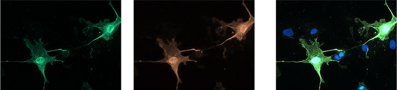 Immunofluoresence of COS-7 cells expressing OLIG2-flag using AVES chicken anti-OLIG2 antibody (green) and rabbit anti-flag antibody (red). Blue is DAPI nuclear stain showing nuclei of both transfected and untransfected cells. Staining shows 100% correspondence between chicken anti-OLIG2 signal and anti-flag in transfected cells.