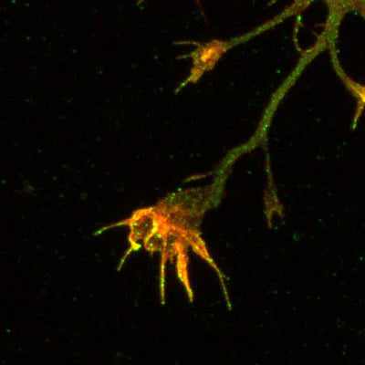 Mouse cortical neurons in culture. The green staining is APP-immunoreactivity, using fluorescein-labeled goat anti-chicken IgY (Product No. F-1005, Aves Labs) and rhodamine-labeled phalloidin as a counterstain. Note the APP-staining of the neurites and growth cones, and the phalloidin-staining limited to the distal growth cones and filapodia. Photomicrograph courtesy of Dr. Philip Copenhaver (OHSU).