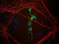 Co-staining of Coronin1 (COR, green, 1:1000 dilution) and Internexin (rabbit antibody, red, 1:500) in a culture of mouse cerebral cortical tissue fixed with 4% paraformaldehyde. Photo by Dr. Gerry Shaw, Univ. Florida.