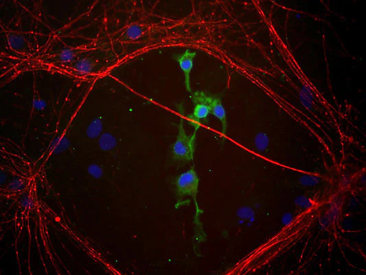 Co-staining of Coronin1 (COR, green, 1:1000 dilution) and Internexin (rabbit antibody, red, 1:500) in a culture of mouse cerebral cortical tissue fixed with 4% paraformaldehyde. Photo by Dr. Gerry Shaw, Univ. Florida.