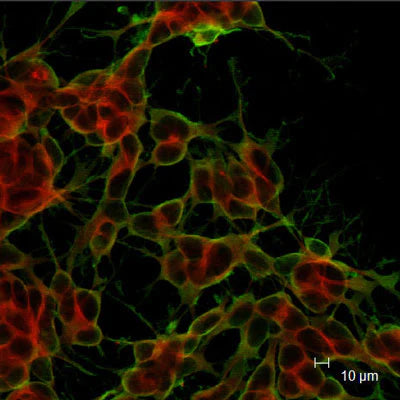  Doublecortin (1:1000 dilution, green) staining of neuroblastoma cells in culture. Red staining is a Golgi apparatus marker. Page Balisch (University of Arizona).