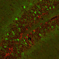 Doublecortin (1:1000 dilution, green) staining of a tissue section (4% paraformaldehyde-fixed, paraffin- embedded) through the cerebellar cortex of a neonatal mouse. Red staining is neurofilament, NF- M, visualized with Texas Red-goat anti-rabbit IgG.