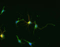 Immunocytochemical staining of GAD-67 (red/yellow) in cultured cortical neurons from a neonatal mouse (C57/Black6). GAD staining was detected using Texas Red goat anti-chicken IgY (1:500). MAP2 staining (green) used a rabbit antibody (1:500). Hoda Ilias, Aves Labs.