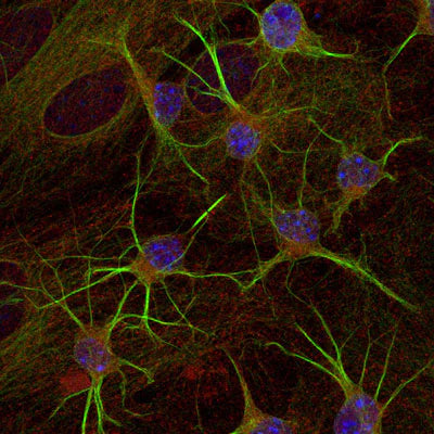 Sph21 neuroblastoma cells in culture. Fixed with 4% paraformaldehyde. GAD.1 (green, 1:1000 dilution) immunoreactivity. Phalloidin (F-actin) (red) staining. DAPI (blue) staining. Photomicrograph from Page Balich (Univ. Arizona).