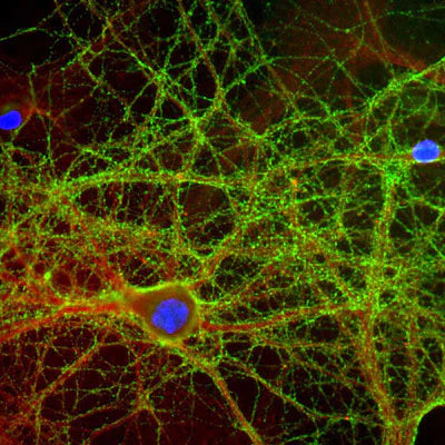Mixed neuron-glial cultures stained with CPCA-GAP43 (green) and rabbit antibody to alpha-II spectrin (RPCA-aII-Spec, red), and DNA (blue). The GAP43 antibody stains numerous axonal and dendritic profiles in these cultures, clearly revealing the submembraneous cytoskeleton and vesicles. Photo by Dr. Gerry Shaw, Univ. Florida.