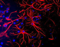 Glial Fibrillary Acidic Protein (GFAP) immunostaining (red) of mixed cortical mouse brain cultures (1:500 dilution). Secondary antibody is Texas Red goat anti-chicken IgY. The blue is DAPI staining of nuclei of all cells, including non-GFAP-positive cells. Photo courtesy of Dr. Gerry Shaw, Univ. Florida.