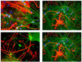 Chicken anti-NSE (green) and mouse anti-GFAP (red).