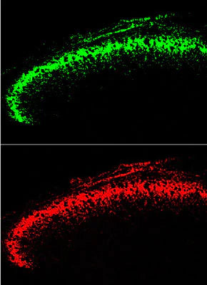 Comparison between GFP immunoreactivity in Rexed Lamina 2 neurons of a transgenic mouse using Aves Labs’ anti-GFP (green) and rabbit anti-GFP (red). The transgenic mouse was generated by placing the GFP cDNA after a POMC gene promoter in the transfected plasmid. Mark Zilka, Univ. North Carolina.