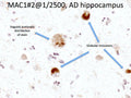 Frame showing MAC-1 immunoreactivity in human microglial cells in an Alzheimer's Disease patient. Photomicrograph taken by Dr. Randy Woltjer, Pathology, OHSU.