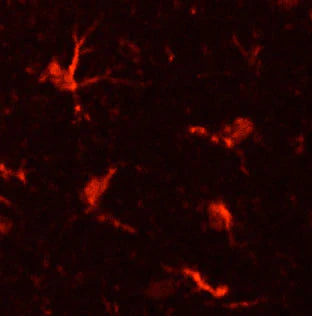 Higher power view of MAC1 immunoreactivity in microglial cells in a paraformaldehyde (4%)-fixed paraffin-embedded section through cerebral cortex of an adult mouse brain, (1:2000 dilution). 2˚ antibody was a Texas Red goat anti-chicken IgY (1:1000 dilution).
