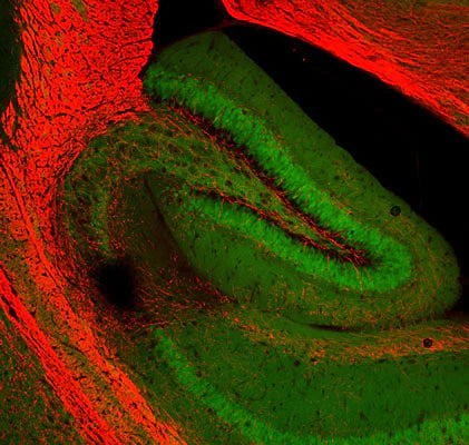 Immunohistochemical staining of MBP (RED) in the hippocampal region of a transgenic adult mouse brain. This particular transgenic mouse expresses low levels of GFP autofluorescence under control of an actin promoter region. The anti-MBP antibody (Aves Labs) was used at a 1:1000 dilution. Dr. Felix Eckenstein, University of Vermont.