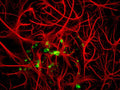 Immunohistochemical staining of the MBP (green) in the nodes of Ranvier of the sciatic nerve of an adult rat. Red counterstaining is a ubiquitous gene product. Blue shows DAPI nuclear staining. Photomicrograph courtesy of Dr. Gerry Shaw, Univ. Florida.