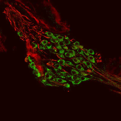 Metabotropic glutamate receptor type 1 (1:1000 dilution, green) immunoreactivity and neurofilament-M (NF-M, rabbit antibody, 1:500 dilution) immunoreactivity in a tissue section through an e18 mouse cochlear ganglion.