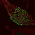 Metabotropic glutamate receptor type 1 (1:1000 dilution, green) immunoreactivity and neurofilament-M (NF-M, rabbit antibody, 1:500 dilution) immunoreactivity in a tissue section through an e18 mouse cochlear ganglion.